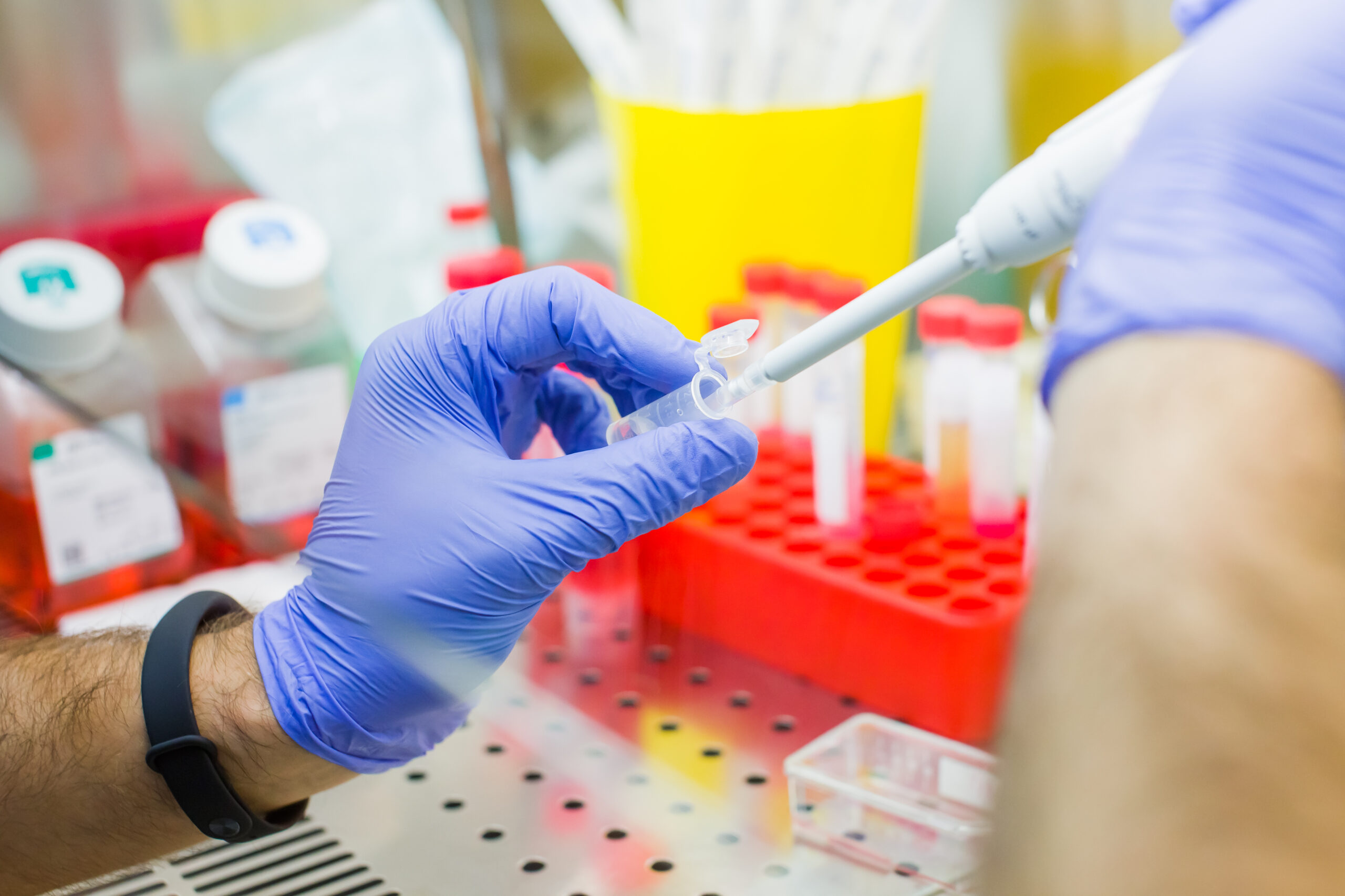 The Revolutionary Role of Stem Cells in Pain Management